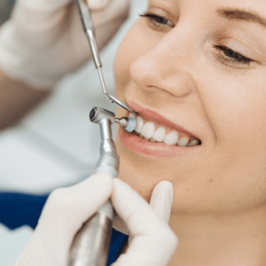 Teeth Cleaning & Polishing