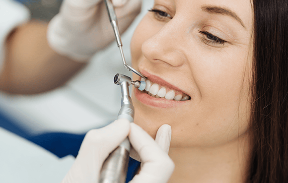 Teeth Cleaning & Polishing