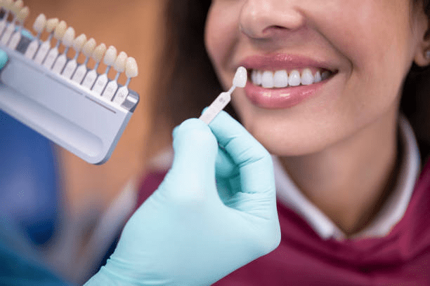 Factors to consider for teeth cleaning & whitening | Dr. Parth Shah 