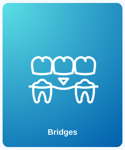 Dental Bridges