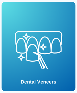 Dental Veneers